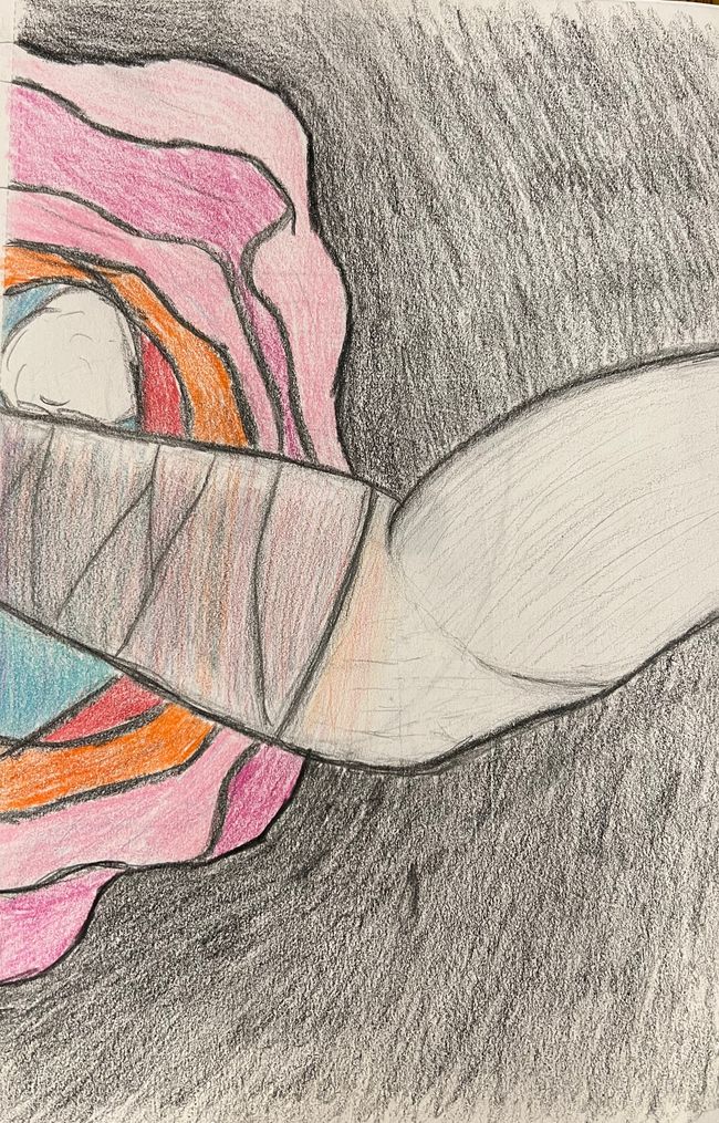 Arm